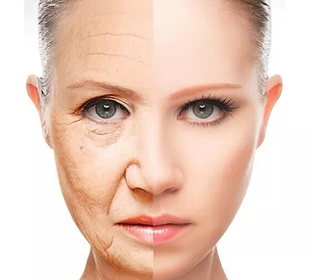 Rigenerazione della Pelle con il Fotoringiovanimento | Estetica Cerbone